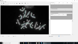 IdeoKar training videoFree karyotyping tool [upl. by Acceb]