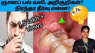 ஞானப் பல் வலி  பிரச்சனைகள்  தீர்வுகள் Wisdom teeth pain and treatment in tamil [upl. by Ehrsam]