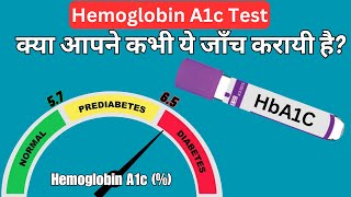 HBA1C test kya hota hai  HbA1c test in hindi  HbA1c test normal range  Hemoglobin A1c test [upl. by Olegnalehcim]