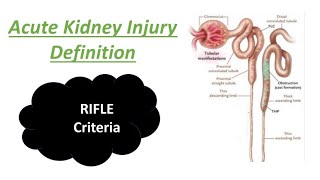 Acute Kidney Injury  RIFLE criteria  AKI  ARF  AKF  Definition  Mightymedicoz [upl. by Jillane]