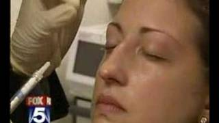 Non Surgical Nose Job By Dr Cameron Rokhsar [upl. by Eornom852]