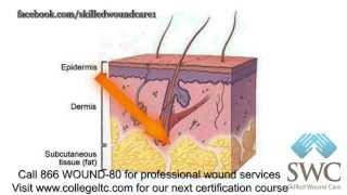 Wound Care 101 [upl. by Hesky]