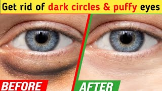 Only 6 mins Eye rejuvenation  Get rid of under eye wrinkles dark circles eye bags Crows feet [upl. by Womack]