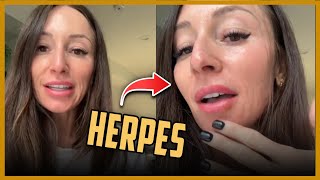 Men Dont Date Woman with Herpes She Wonders Why  Why Men no Longer Approach Women [upl. by Sihun]