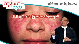 SLE ခေါ် အရေပြားလေးဖက်နာရောဂါ Systemic Lupus Erythematosus  Dr Khin Maung Lwin FAME [upl. by Ajay]