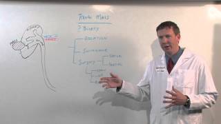 Treatments for Kidney Tumors  Kenneth Nepple MD [upl. by Roderich]