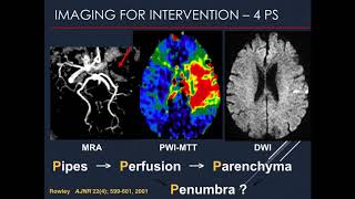 SIRRFS Webinar 582018 Clinical stroke care and recent randomized control trials [upl. by Alden341]