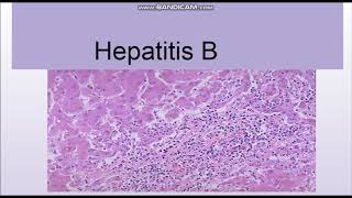 Hepatitis B Structure and Lab diagnosis [upl. by Gans]