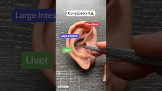 Ear Acupuncture for Constipation acupunctureworks [upl. by Adnwahs514]