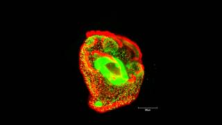 ZEISS Lightsheet Z1  Nemertea pilidium larva ventral view [upl. by Mal980]