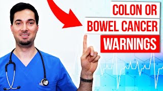 Colon cancer symptoms and signs of bowel cancer [upl. by Eusadnilem]