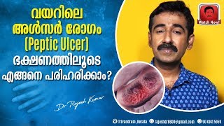 വയറിലെ അൾസർ രോഗം Peptic Ulcer ഭക്ഷണത്തിലൂടെ എങ്ങനെ പരിഹരിക്കാം [upl. by Maryjo]