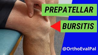 Prepatellar Bursitis Anterior knee pain and swelling [upl. by Eima730]