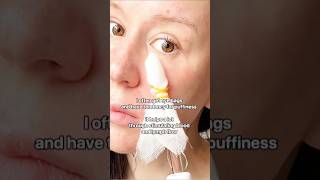 High frequency facialskintreatmentdarsonvalbeautyacnefacialbacktoschoolskincareroutineacne [upl. by Neenaj]