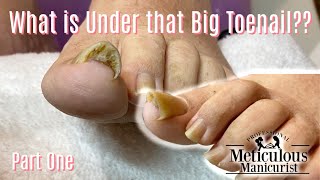 Take Care of Your Toenail Pain at Home Online Ingrown Pedicure Lesson [upl. by Paula]