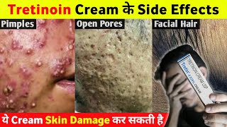 Tretinoin Cream के ये Side Effects आप नहीं जानते होगे 😱 [upl. by Xxam]