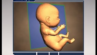 Paso a paso para obtener una imagen fetal perfecta de 3D4D [upl. by Tarrel]