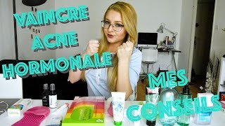 Combattre lacné hormonale  Mes Conseils [upl. by Luahs]