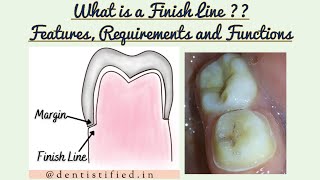 Finish lines in Fixed Partial Denture Finish Lines in Tooth preparation Functions and Requirements [upl. by Einnal161]