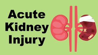 Acute Kidney Injury AKI  causes and management [upl. by Marion905]