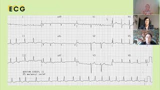 Atrial Fibrillation the geriatricians approach  Bite sized learning from the MDTea Help Series [upl. by Ona]