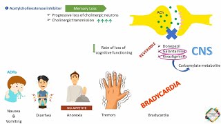 ALZHEIMERS DISEASE amp ITS TREATMENT [upl. by Elianora]