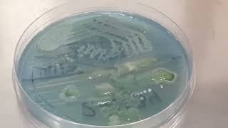 Lactose fermenting colonies of Raoultella ornithinolytica became Nonlactose fermenting after old [upl. by Nivag]