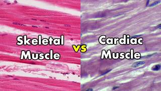 Differentiating Skeletal Muscle and Cardiac Muscle  Striations vs Intercalated Discs [upl. by Hirasuna350]