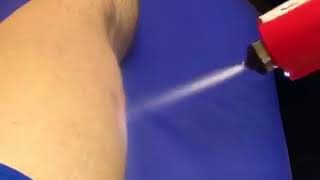 Quad Treatment using Kaasen Cryo Stimulation [upl. by Ahsilek784]