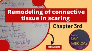 Remodeling of Connective tissues in scaringRobbins pathologypathology robbinspathology repair [upl. by Aehc]