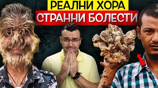 13 от Найстранните ЗАБОЛЯВАНИЯ които ЩЕ ВИДИТЕ някога [upl. by Arvind]