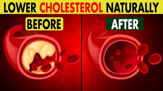 TOP 7 Natural Ways to Lower Cholesterol [upl. by Eatnoled]