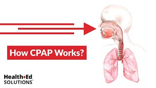 One Quick Question How Does CPAP Work [upl. by Marie-Jeanne]