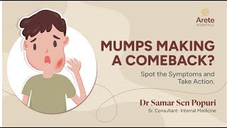 Mumps Causes Symptoms and Treatments  Dr Samar Sen P  Arete Hospitals mumps [upl. by Gomar522]