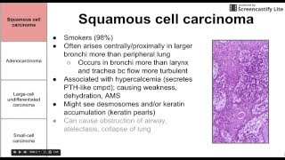 Cancers of the lung [upl. by Vescuso]