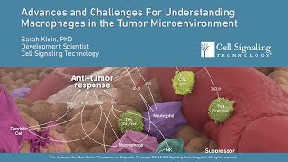 Advances and Challenges for Understanding Macrophages in the Tumor Microenvironment [upl. by Weber]