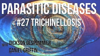 Parasitic Diseases Lectures 27 Trichinellosis [upl. by Hpeseoj]