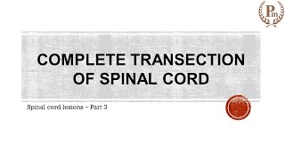 Features of complete transection of Spinal Cord [upl. by Aenal628]