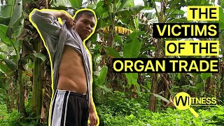 Organ Thieves Inside the Dark World of Organ Trafficking  Organ Trade Documentary [upl. by Eelanaj]