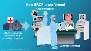 Understanding ERCP Endoscopic Retrograde Cholangiopancreatography [upl. by Odicalp497]