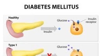 Diabetes Mellitus  Part 3  Naturopathy treatment [upl. by Nyrahtak]