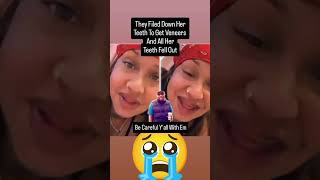 Veneers Denture Went Wrong hiphop wshh hiphopculture hiphopsociety 40club [upl. by Khudari]