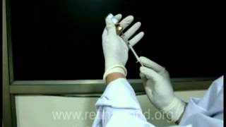 INTRAVITREAL INJECTION PREPARATION [upl. by Addiego]