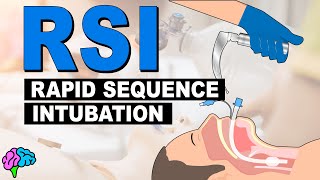 What is Rapid Sequence Intubation RSI [upl. by Yhtimit]