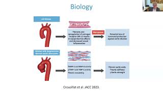 Sexual Dimorphism in Thoracic Aortic Disease [upl. by Erapsag570]