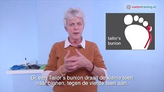 Tailors bunion [upl. by Chubb]