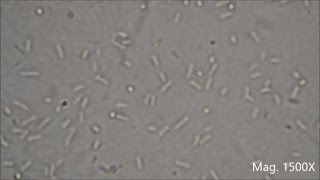 Bacteria under the Microscope E coli and S aureus [upl. by Jacenta]