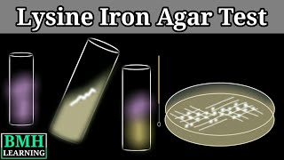 Lysine Iron Agar Test  Lysine Decarboxylase Test [upl. by Karlise544]