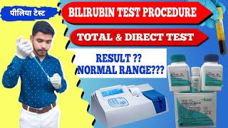 Total amp Direct Bilirubin test procedure practical video पीलिया टेस्टjaundice testserum bilirubin [upl. by Dnalra232]