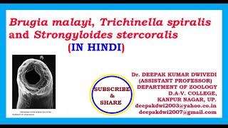 BRUGIA MALAYI TRICHINELLA SPIRALIS STRONGYLOIDES STERCORALIS IN HINDI [upl. by Armilda]